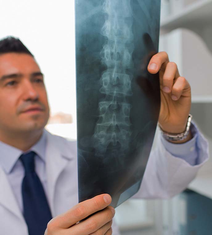 Doctor at South Bay Wellness Center examining patient x-rays for spine injury